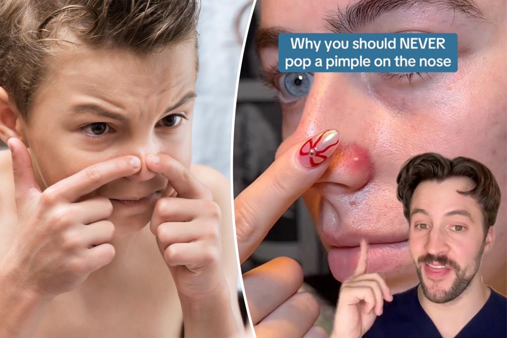 I'm a dermatologist - never pop a pimple that falls in the "triangle of death"